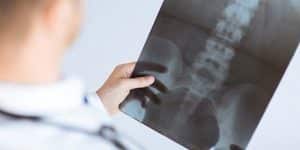 Steps Healthy Spine