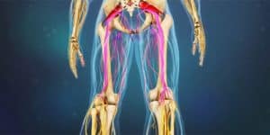 Sciatica Symptoms & Signs